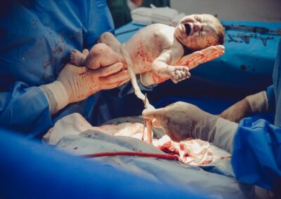 5 Myths About C-Sections We Need To Dispel Right Now