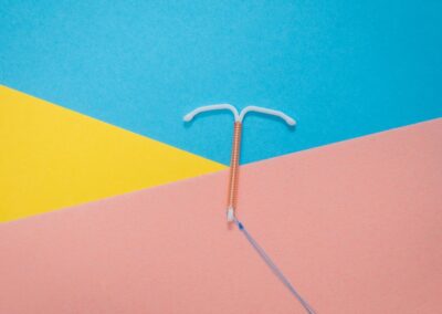 People are getting IUDs and Plan B ahead of a possible post-Roe future